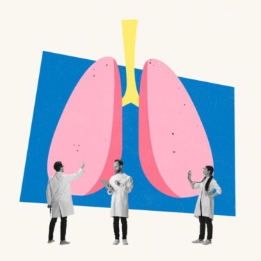 Ein Diagramm von menschlichen Lungen, vor dem drei Personen in weißen Kitteln stehen und jeweils zeigen, Notizen machen, und ein Stethoskop an die Lungen halten.